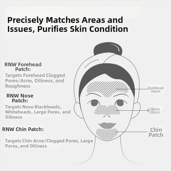 RNW nosies pleistras juodų dėmių šalinimui – T-zonos priežiūra, 10 pleistrų, pašalina juodus taškus, ramina ir minkština odą, tinkamas normaliam, riebiam, sausam ir mišriam odos tipui