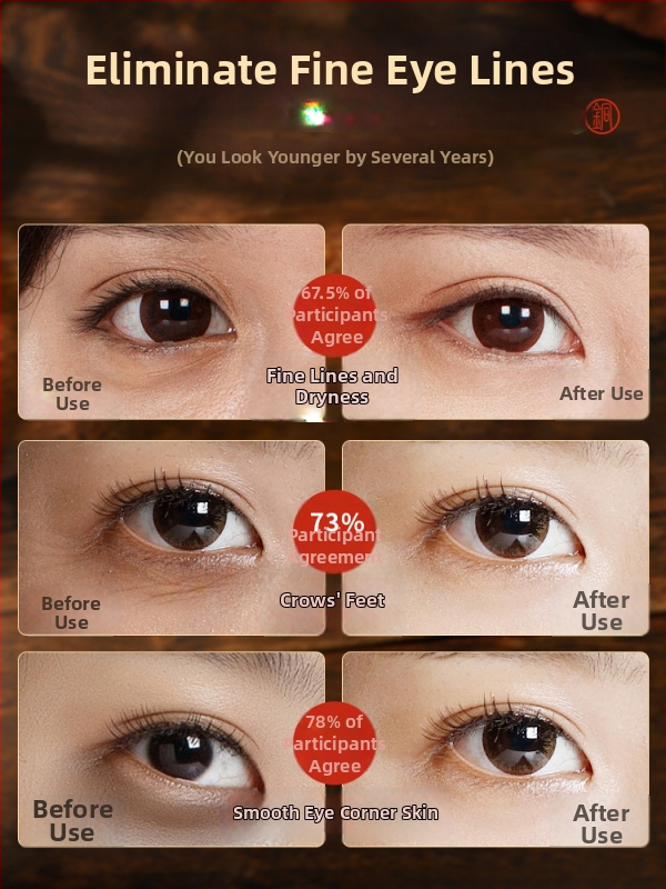 Bronzas sejas masieris ar acu akupunktūras instrumentu un sandaļkoku