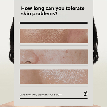 Maska s kyslíkom – krém-gél textúra, malé bublinky kyslíka, regulácia mastnoty, 3-ročná trvanlivosť