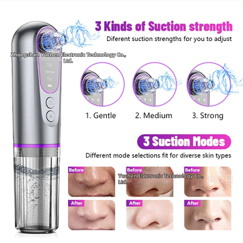 Elektriline pöörlev mustpeade eemaldaja – YC155, 3 kiirust, pooride puhastus