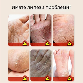 Пластир за напукани ръце и крака с конско масло, 50 лепенки/кутия, мехлемоподобна текстура, билков аромат