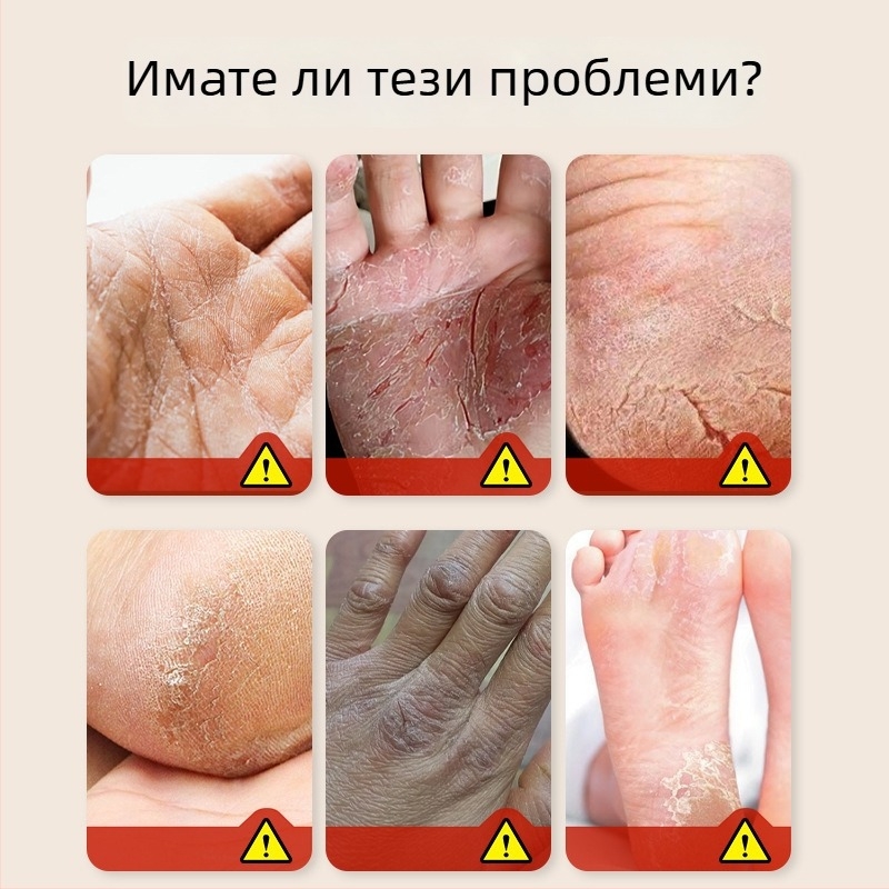 Пластир за напукани ръце и крака с конско масло, 50 лепенки/кутия, мехлемоподобна текстура, билков аромат