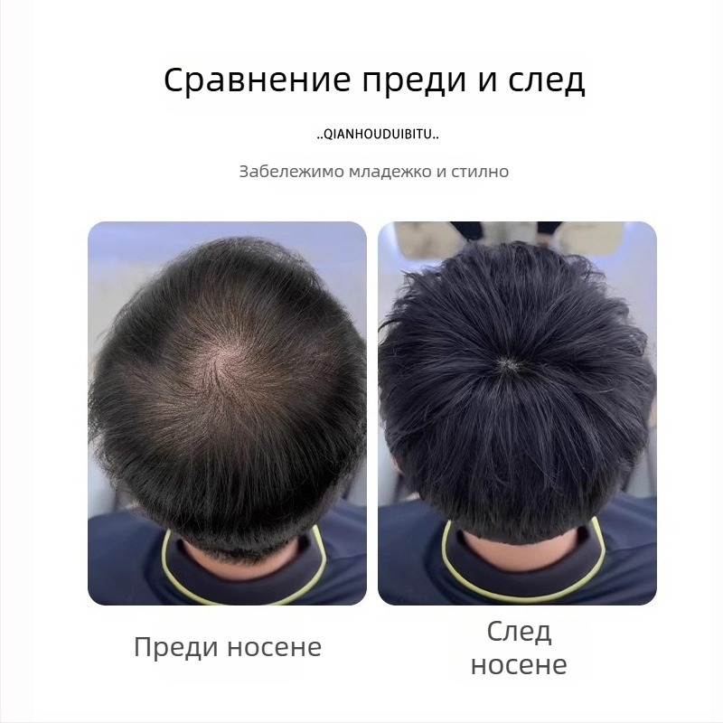 Мъжка къса естествена перука с горна добавка за обем, механично строителство, термоустойчива синтетика, модели BF374 BF375 BF376