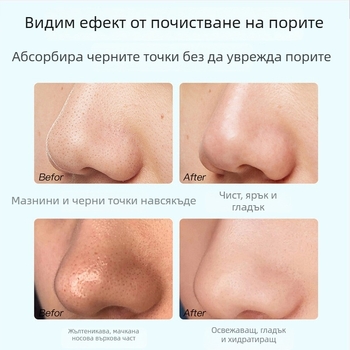 Маска за премахване на черни точки – три части, екстракт от чай, грижа за T-зоната, стягане на порите, контрол на омазняването, хидратация