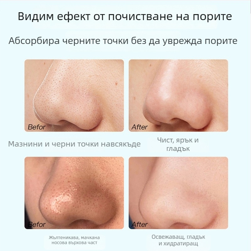 Маска за премахване на черни точки – три части, екстракт от чай, грижа за T-зоната, стягане на порите, контрол на омазняването, хидратация