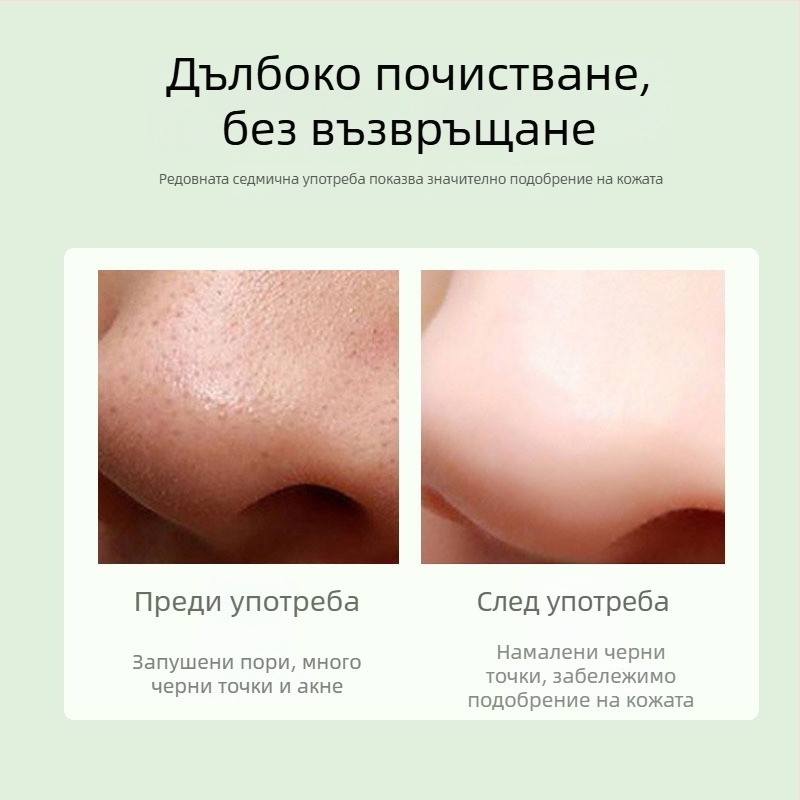 Вакуумен прибор за лице за премахване на черни точки, модел DYM028, Define Beauty, видимо премахва черни точки и акне, 3 нива на мощност