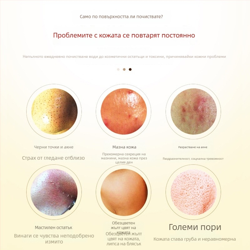 YKANG RF козметично устройство за лице - преносимо средство за почистване с отрицателни йони, вградена батерия <300 mAh, IPX0