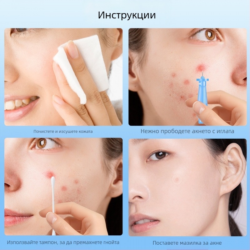 Еднократно използваема игла за екстракция на акне, стоманена, артикул z7NAR7rA, марка Друга