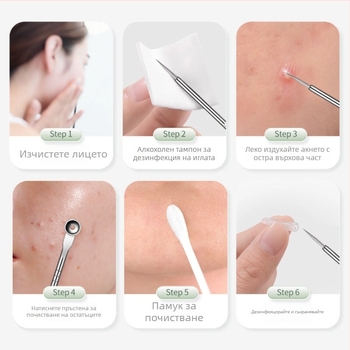 Неръждаем стоманен комплект от 5 игли за акне, ъпгрейднат прецизен екстрактор за черни точки и пори