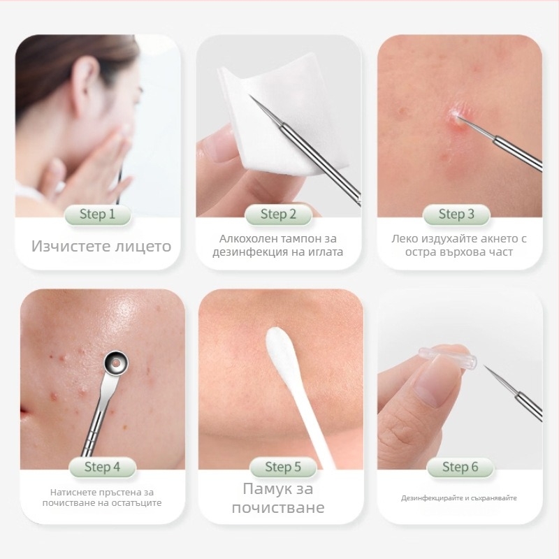 Неръждаем стоманен комплект от 5 игли за акне, ъпгрейднат прецизен екстрактор за черни точки и пори