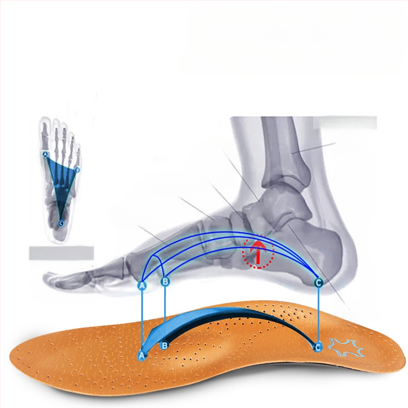 0 tipo odinis vidpadis plokščiapėdystės palaikymui vyrams ir moterims, XO tipo pėdos valgus vidinis aštuonių ženklų korekcinis vidpadis urmu