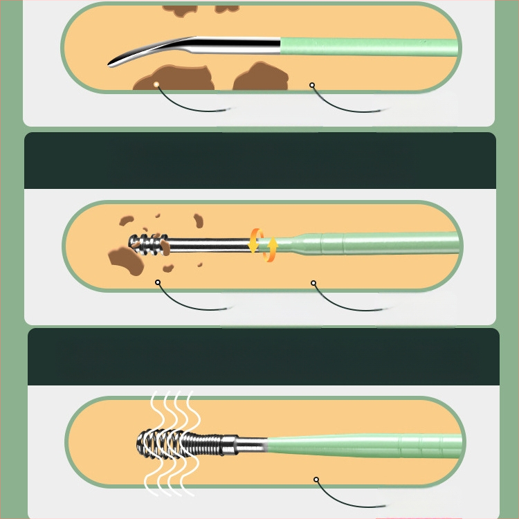 Kõrvakaevamise lusikakomplekt kõrvakaevamise artefakt professionaalne kõrvavaigu pandlaga kõrvakaevamise tööriist lastele ja täiskasvanutele