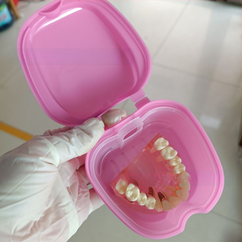 Zobu protēžu ievietošanas kaste Pilna zobu protēžu kaste Zobu protēžu kaste Pilna zobu protēžu kaste Zobu protēžu kaste Zobu protēžu kaste ar tīkliņu Zobu protēžu kaste Ābolu zobu protēžu kaste 53