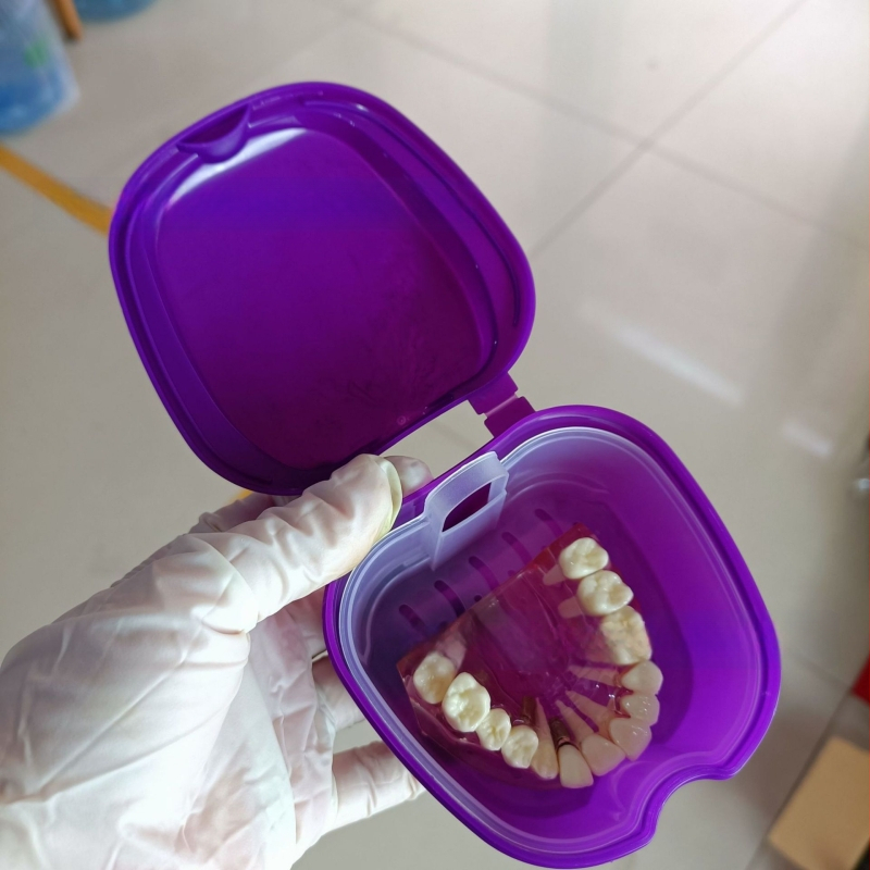 Zobu protēžu ievietošanas kaste Pilna zobu protēžu kaste Zobu protēžu kaste Pilna zobu protēžu kaste Zobu protēžu kaste Zobu protēžu kaste ar tīkliņu Zobu protēžu kaste Ābolu zobu protēžu kaste 53