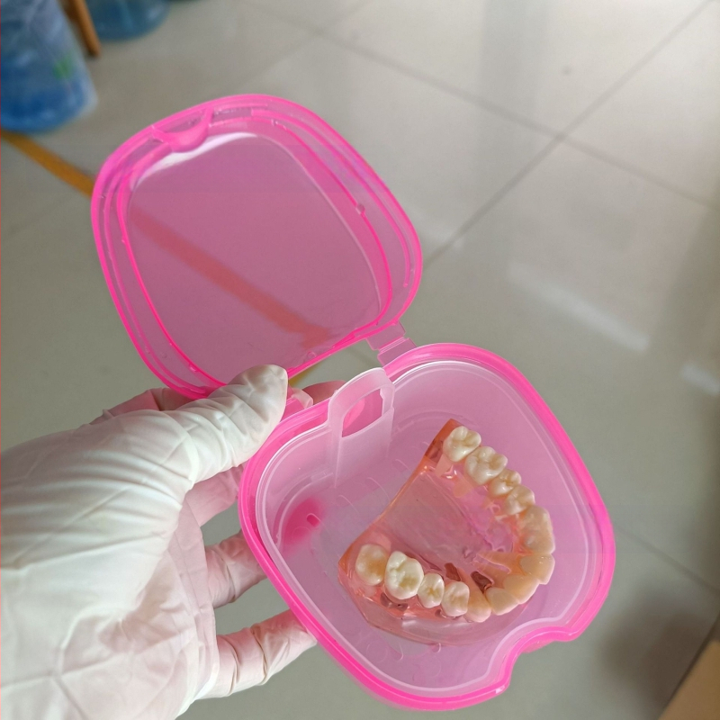 Zobu protēžu ievietošanas kaste Pilna zobu protēžu kaste Zobu protēžu kaste Pilna zobu protēžu kaste Zobu protēžu kaste Zobu protēžu kaste ar tīkliņu Zobu protēžu kaste Ābolu zobu protēžu kaste 53