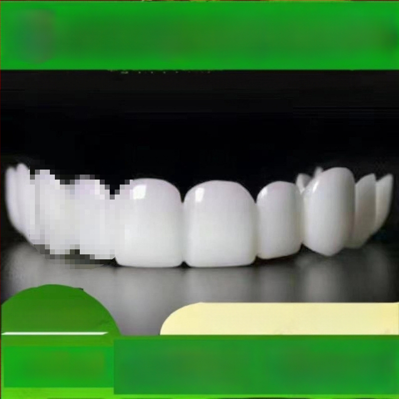 Hambaproteesid, universaalsed breketid eakatele, puuduvate hammaste täitmine, hambavahede õõnsused, mehed ja naised, inetute breketite katmine ilma aukudeta