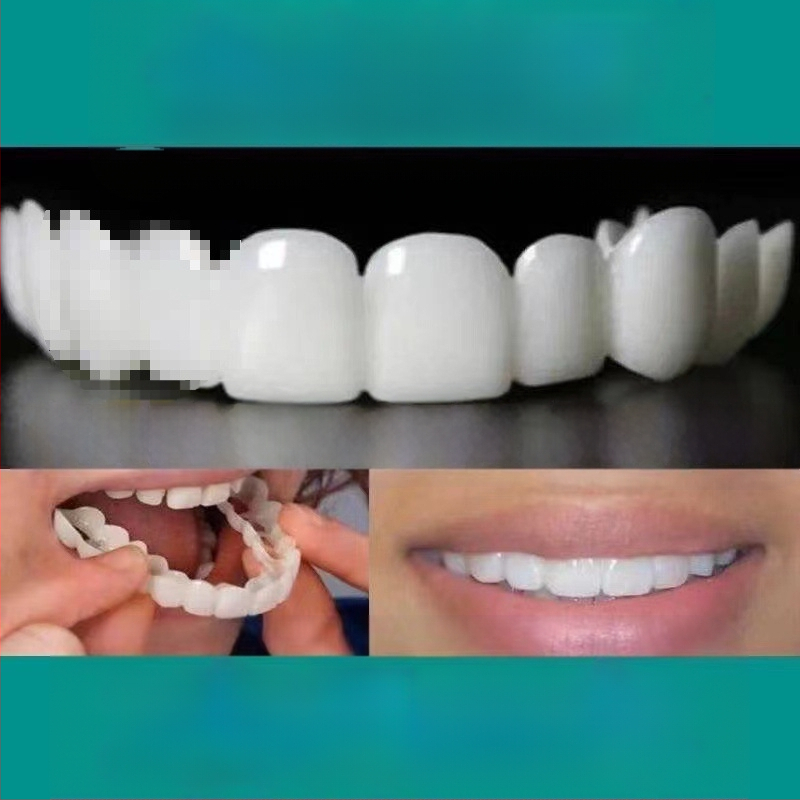 Hambaproteesid, universaalsed breketid eakatele, puuduvate hammaste täitmine, hambavahede õõnsused, mehed ja naised, inetute breketite katmine ilma aukudeta