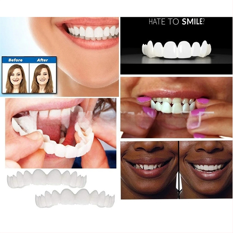 Snap-on-smile Piiriülesed proteesid Loovad hambad Ajutised võltsimiskindlad breketid