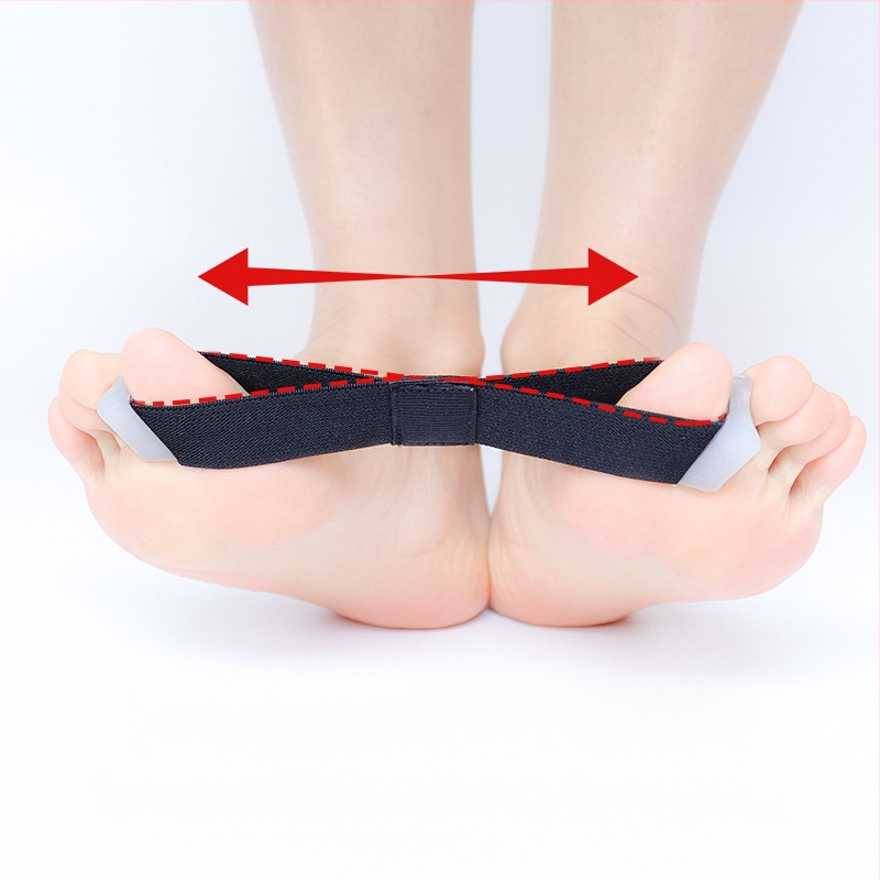 Vienpusis nykščio valgus įtvaras, kurį galima nešioti dieną ir naktį, su didžiojo pėdos kaulo įtempimo diržu, perdengiamu pirštų atskyrimo audiniu.