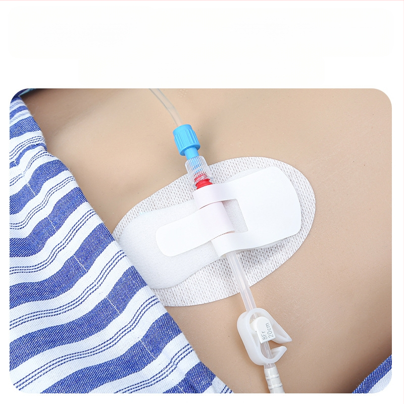 Medicininis kateterio fiksavimo pleistras kateterio fiksavimo pleistras kateterio fiksavimo tvarstis drenažo vamzdelis PICC kateterio fiksavimo pleistras