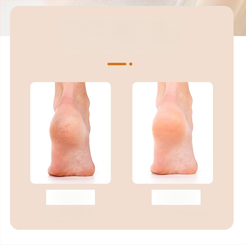 Pėdų šlifavimo įrankis, populiari ilgakotė nano stiklo pėdų dildė negyvai odai ir nuospaudoms šalinti, pedikiūro ir pėdų šveitimo artefaktai sandėlyje