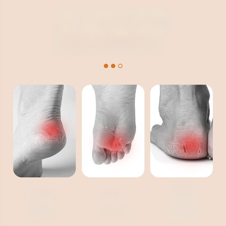 Pėdų šlifavimo įrankis, populiari ilgakotė nano stiklo pėdų dildė negyvai odai ir nuospaudoms šalinti, pedikiūro ir pėdų šveitimo artefaktai sandėlyje