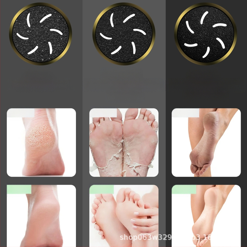 Външнотърговско място Нови електрически анти-летящи люспи, устройство за премахване на мъртва кожа, шлифовъчна машина за крака, белач за крака, машина за педикюр, устройство за грижа за краката