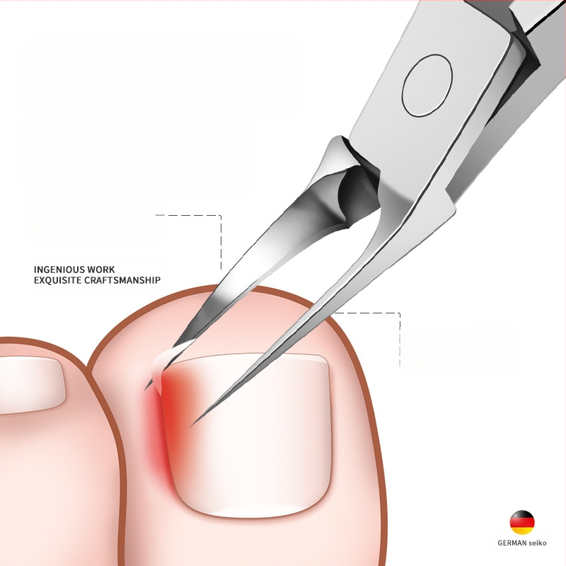 Naujos nagų kirpimo mašinėlės, nagų grioveliai, specialios nagų žirklės, įstrižos burnos prailginimas, vienos vanago žnyplės, įaugusio nago uždegimas, pedikiūro nagų kirpimo mašinėlės