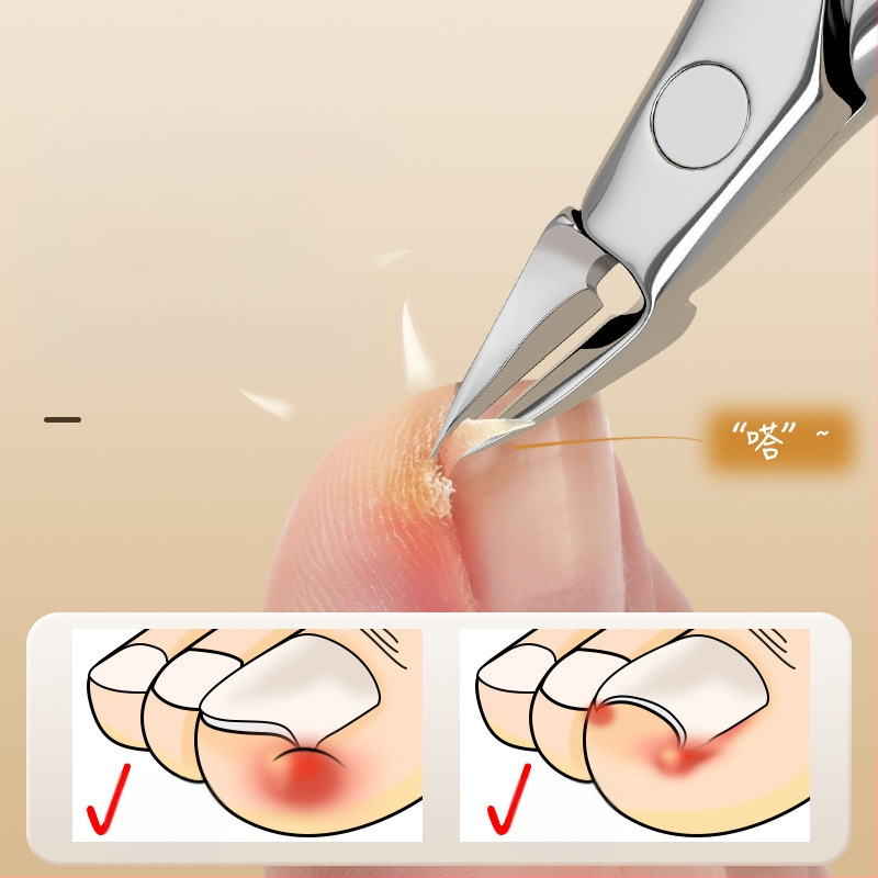 Üksikud küünetangid, spetsiaalsed küünetangid küünesoonte jaoks, sobivad küünetangid, kaldus pediküüri tööriistad, olecranon küünetangid