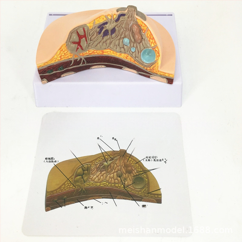 Μοντέλο παθολογίας μαστού για ιατρική εκπαίδευση