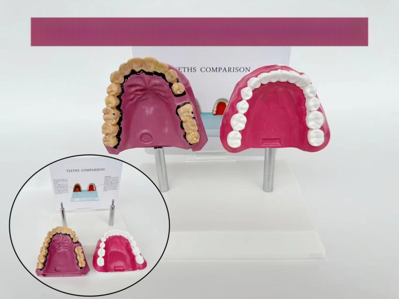 Dantų anatomijos modelis su struktūrine forma mokymui ir burnos sveikatos švietimui