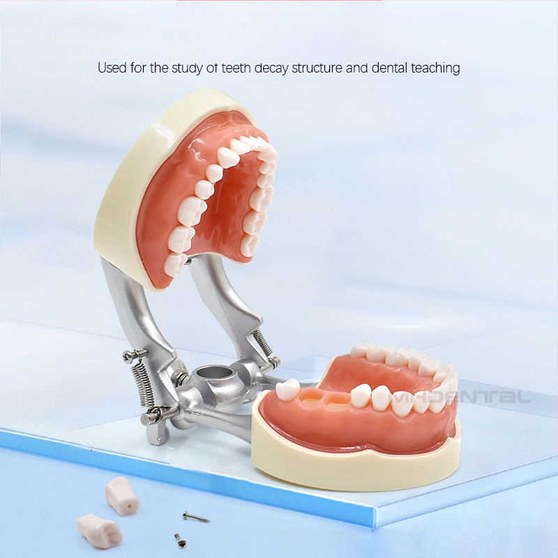 MEHO зъболекарски обучителен модел (модел на зъб) - ABS материал; за тренировка и обучение; кутия: 1 бр.