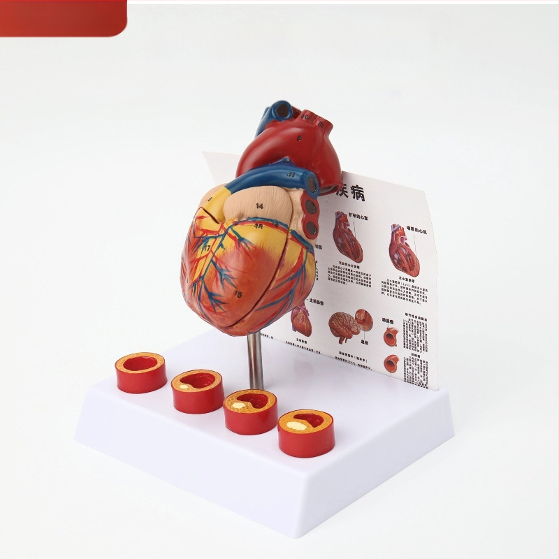 Сърдечен анатомичен модел за обучение - PVC модел на вътрешни органи, образователна експозиция, Excellence