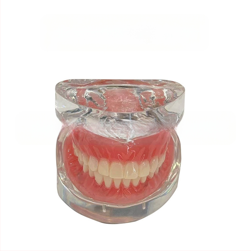 Prakses zobu implantāta modelis – augšžoklis un apakšžoklis, puse mute ar 2 vai 4 implantātiem