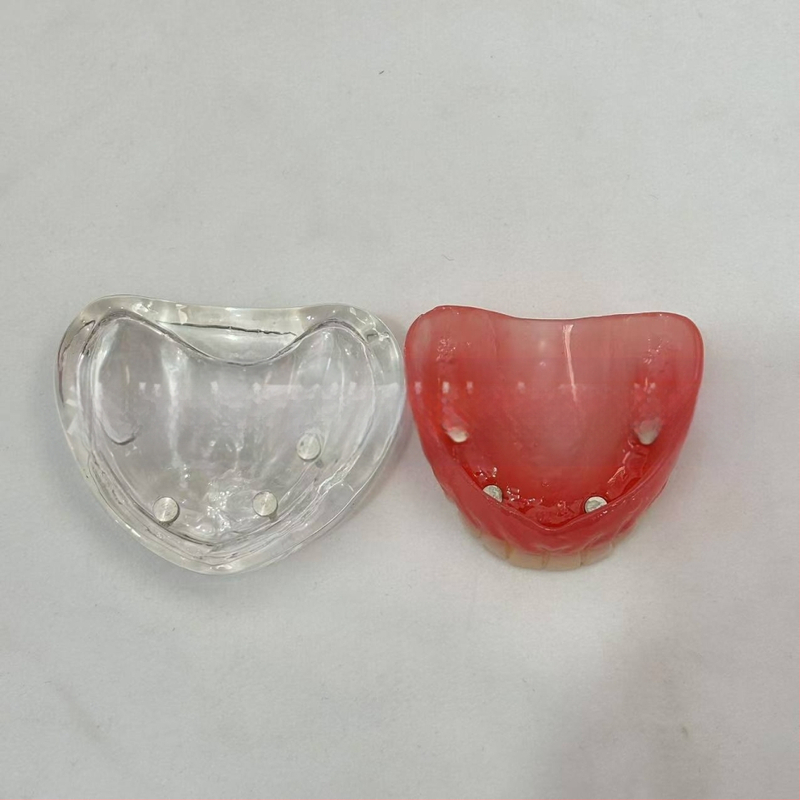 Prakses zobu implantāta modelis – augšžoklis un apakšžoklis, puse mute ar 2 vai 4 implantātiem