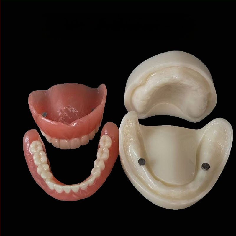 Prakses zobu implantāta modelis – augšžoklis un apakšžoklis, puse mute ar 2 vai 4 implantātiem