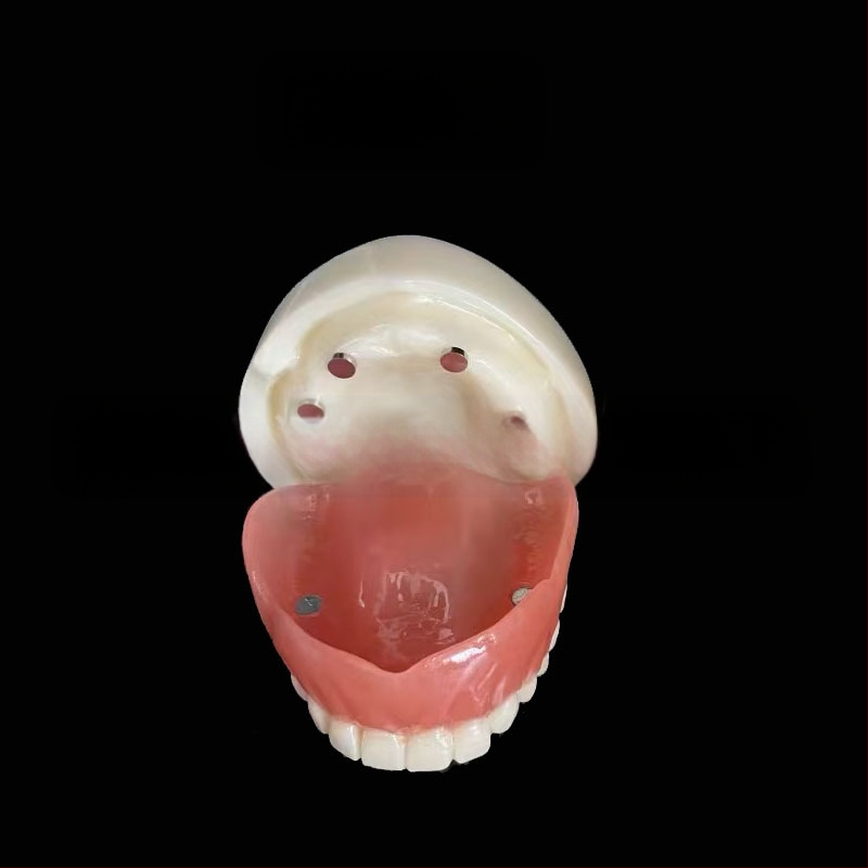 Prakses zobu implantāta modelis – augšžoklis un apakšžoklis, puse mute ar 2 vai 4 implantātiem