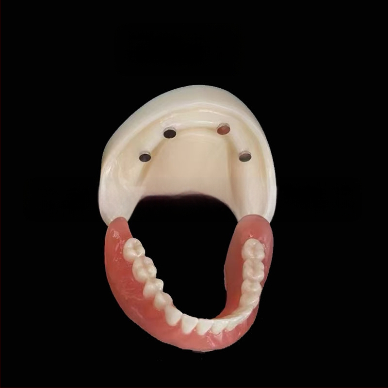 Prakses zobu implantāta modelis – augšžoklis un apakšžoklis, puse mute ar 2 vai 4 implantātiem