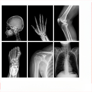 Jucărie educațională Montessori-Reggio cu lumină și umbră, inel DIY cu raze X, pentru sugari 0–3 ani, colț științific pentru fete