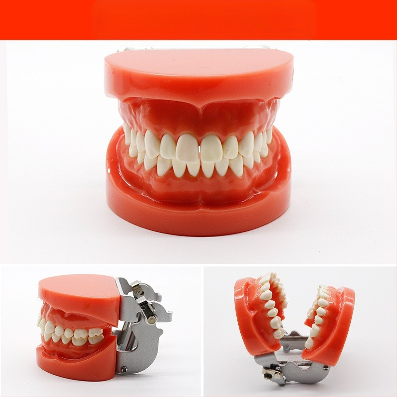 Μοντέλο διδασκαλίας οδοντιατρικής με παθολογική αποκατάσταση και τυπικό καλούπι εμφυτευμάτων — εγχώριο εμπορικό σήμα, με εκτυπωμένο λογότυπο, κατάλληλο για την οδοντιατρική εκπαίδευση