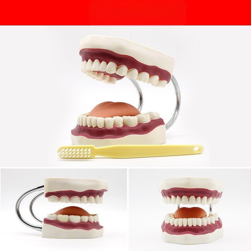 Μοντέλο διδασκαλίας οδοντιατρικής με παθολογική αποκατάσταση και τυπικό καλούπι εμφυτευμάτων — εγχώριο εμπορικό σήμα, με εκτυπωμένο λογότυπο, κατάλληλο για την οδοντιατρική εκπαίδευση