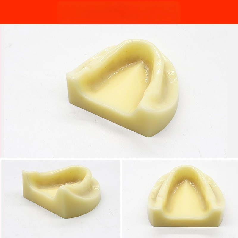 Μοντέλο διδασκαλίας οδοντιατρικής με παθολογική αποκατάσταση και τυπικό καλούπι εμφυτευμάτων — εγχώριο εμπορικό σήμα, με εκτυπωμένο λογότυπο, κατάλληλο για την οδοντιατρική εκπαίδευση