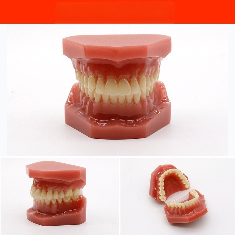 Μοντέλο διδασκαλίας οδοντιατρικής με παθολογική αποκατάσταση και τυπικό καλούπι εμφυτευμάτων — εγχώριο εμπορικό σήμα, με εκτυπωμένο λογότυπο, κατάλληλο για την οδοντιατρική εκπαίδευση