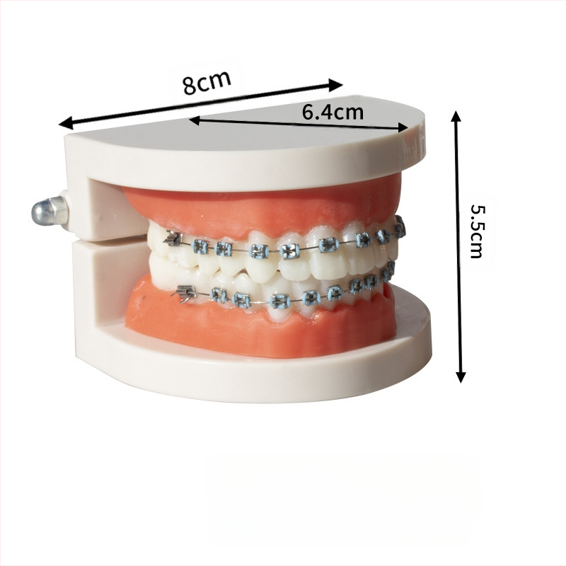Ortodontikus fém bracket modell bemutatóhoz, felnőtteknek, 140 g, dobozban 100 darab, helyi márka