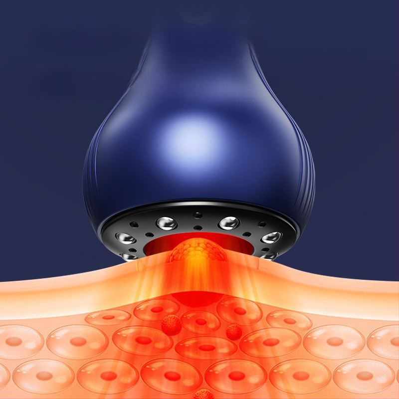 Vakuuminis kupavimo įrenginys su meridianų masažu, USB maitinimas, modelis A700, temperatūros reguliavimas 30–60°C, devyni greičiai, ABS korpusas
