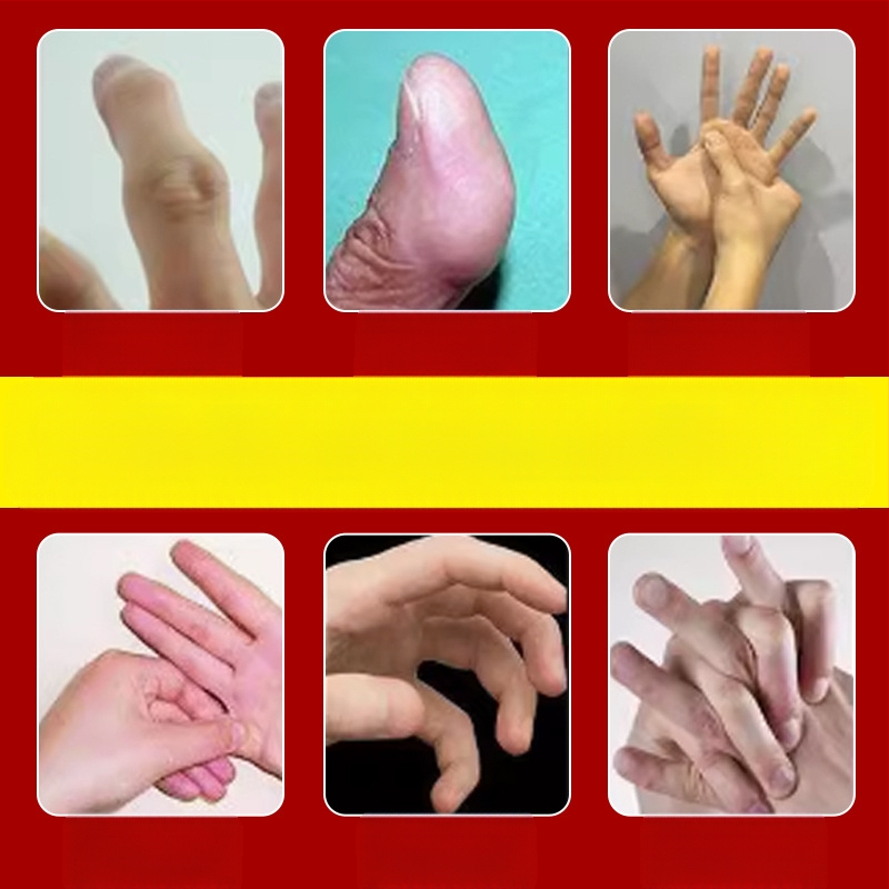 Ai Renyi sausgyslės kapsulės pasta riešui ir pirštų sąnariams – neaustas audinys su žolelių mišiniu, modelis 00667