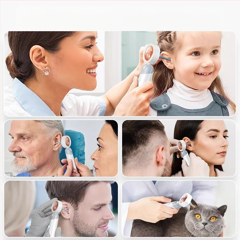 Χειροκίνητο ενδοσκόπιο αυτιού και λάρυγγα με οθόνη HD – οπτικό ωτοσκόπιο με WiFi και Glow ακροφύσιο για αυτί