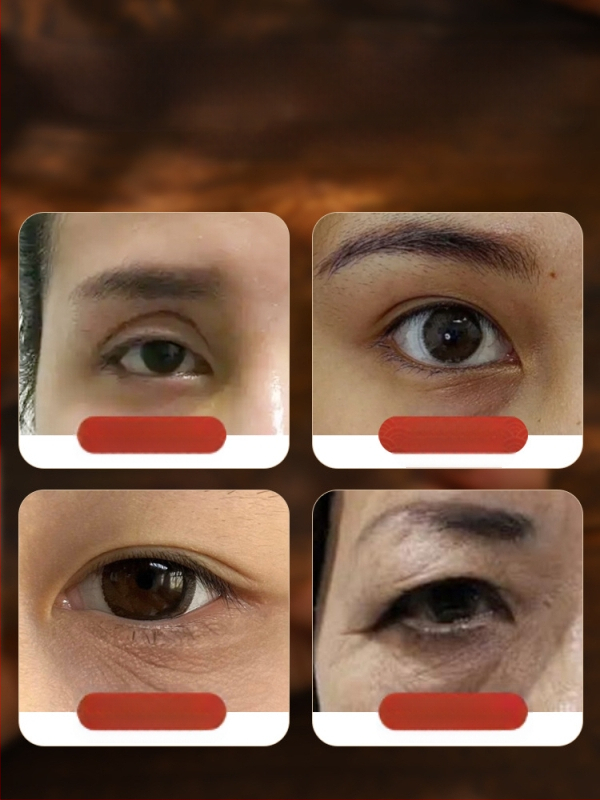 Bronzinė ilga akupunktūrinė lazdelė kojų masažui – akupresūros įrankis su meridianų žemėlapiu ir apsauginiu gaubtuvu