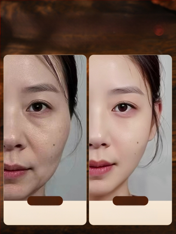 Bronzinė ilga akupunktūrinė lazdelė kojų masažui – akupresūros įrankis su meridianų žemėlapiu ir apsauginiu gaubtuvu