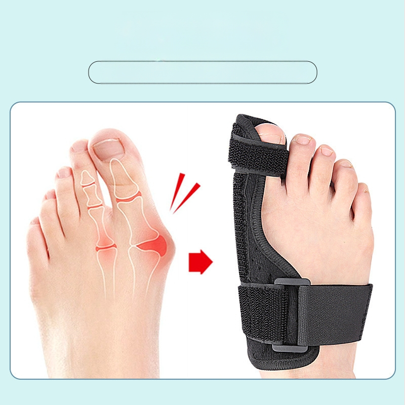 Unisex piršto atskirtukas hallux valgus su nykščio palaikymu – apsauginė danga, medžiagos: flanelė, kempinė, Velcro, plastikinė juostelė; serija Separator; stilius Hallux valgus; tinka visiems metų laikams